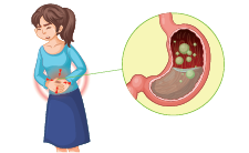 Gastrointestinal Disorders