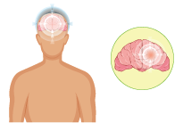 Neurological & Immunological Disorders