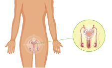 Urogenital Disorders